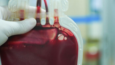 Hoaks! Vaksin Covid-19 Dapat Mengubah Warna Darah